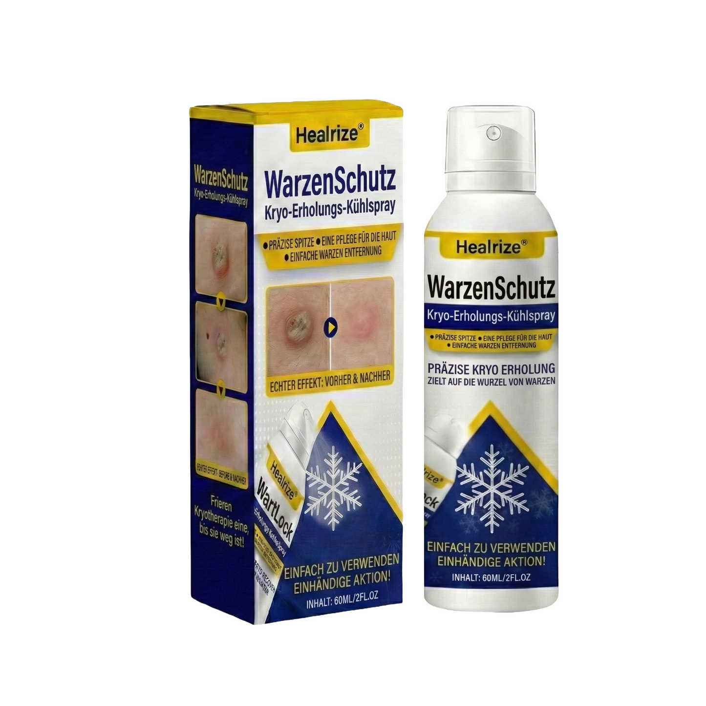 🔥𝙈ä𝙧𝙯-𝘼𝙣𝙜𝙚𝙗𝙤𝙩 | Healrize® WartLock Cryo-Recovery Cooling Spray❄️