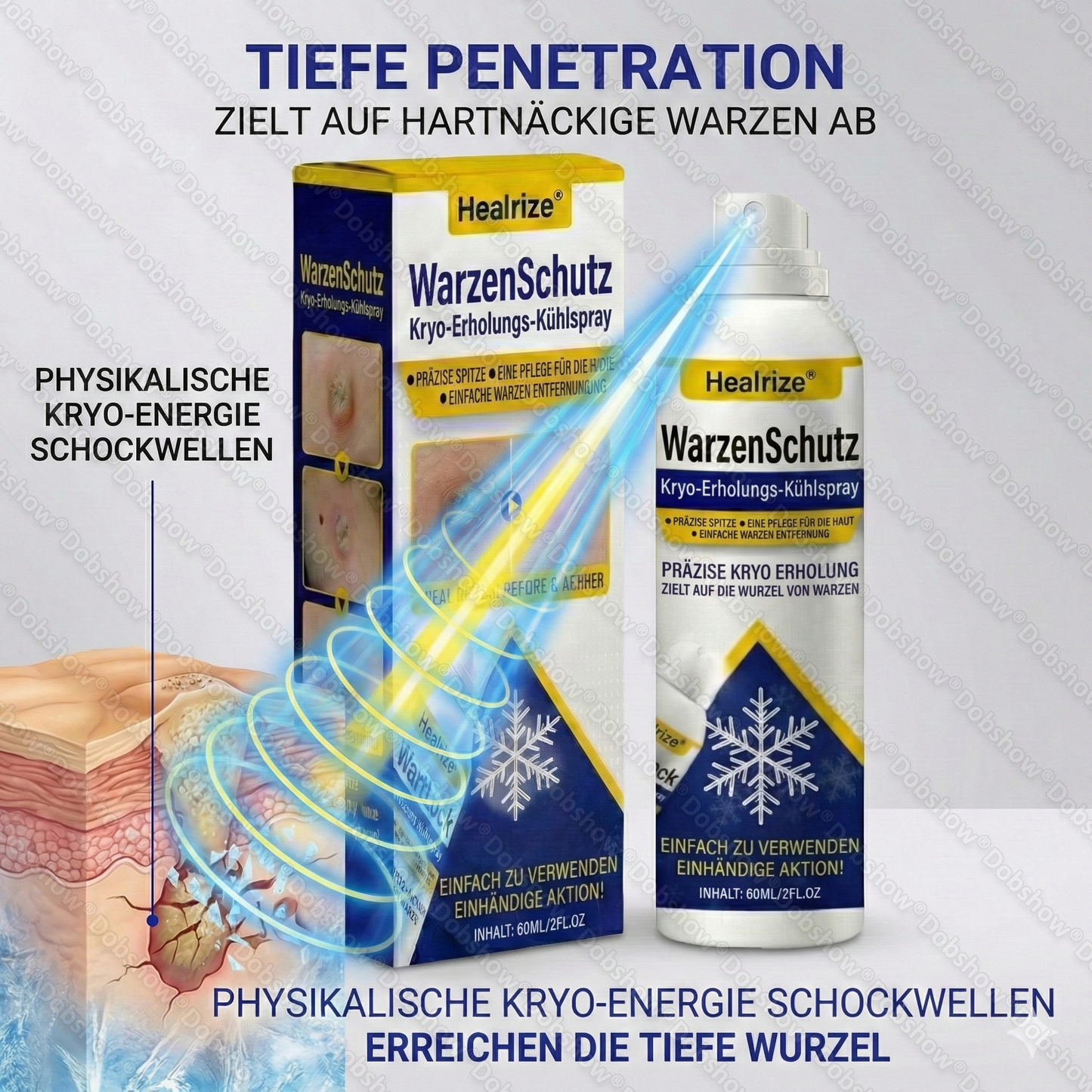 🔥𝙈ä𝙧𝙯-𝘼𝙣𝙜𝙚𝙗𝙤𝙩 | Healrize® WartLock Cryo-Recovery Cooling Spray❄️