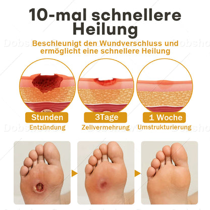 Healrize® GlucoShield Bienengift-Wundspray