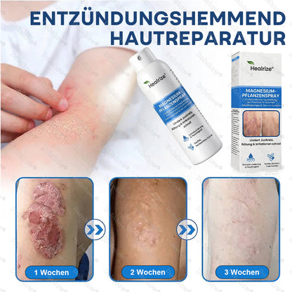 ✨DE 𝐎𝐟𝐟𝐢𝐜𝐢𝐚𝐥  𝐒𝐭𝐨𝐫𝐞 | Healrize® Magnesium-Pflanzenspray – Fortschrittliche Hautregeneration bei Schuppenflechte & Ekzemen | Schnelle Linderung, steroidfrei
