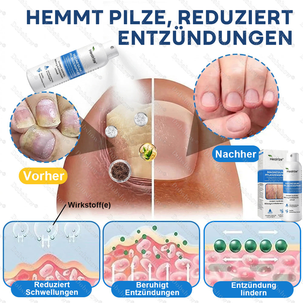 ✨DE 𝐎𝐟𝐟𝐢𝐜𝐢𝐚𝐥  𝐒𝐭𝐨𝐫𝐞 | Healrize® Magnesium-Pflanzenspray – Fortschrittliche Hautregeneration bei Schuppenflechte & Ekzemen | Schnelle Linderung, steroidfrei