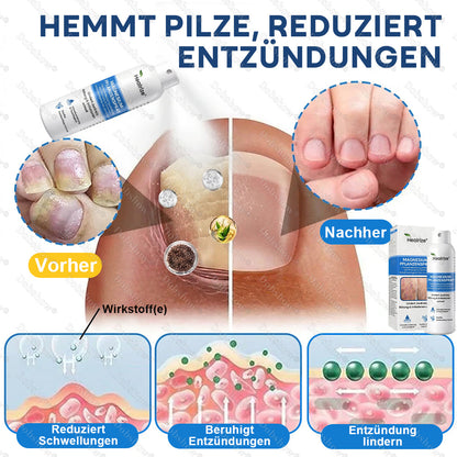 ✨DE 𝐎𝐟𝐟𝐢𝐜𝐢𝐚𝐥  𝐒𝐭𝐨𝐫𝐞 | Healrize® Magnesium-Pflanzenspray – Fortschrittliche Hautregeneration bei Schuppenflechte & Ekzemen | Schnelle Linderung, steroidfrei