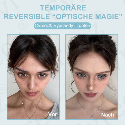 Healrize® EyeCandy Tropfen🔥