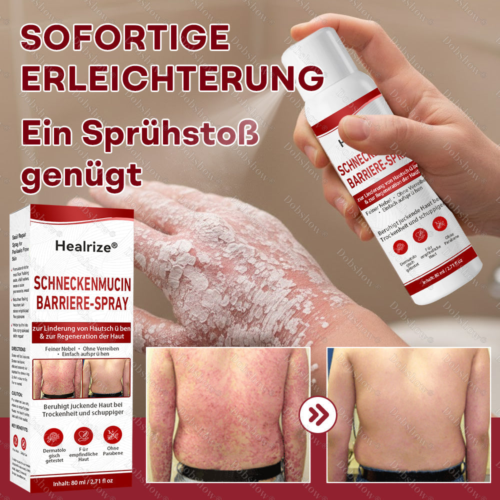 🎁DE 𝐎𝐟𝐟𝐢𝐜𝐢𝐚𝐥  𝐒𝐭𝐨𝐫𝐞 | Healrize® Schneckenmucin-Barriere-Spray zur Linderung von Hautschüben und zur Regeneration der Haut-𝘿𝙚𝙪𝙩𝙨𝙘𝙝𝙡𝙖𝙣𝙙𝙨 𝙉𝙧. 1 𝙨𝙥𝙧ü𝙝𝙗𝙖𝙧𝙚 𝘽𝙖𝙧𝙧𝙞𝙚𝙧𝙚-𝙋𝙛𝙡𝙚𝙜𝙚 𝙗𝙚𝙞 𝙋𝙨𝙤𝙧𝙞𝙖𝙨𝙞𝙨