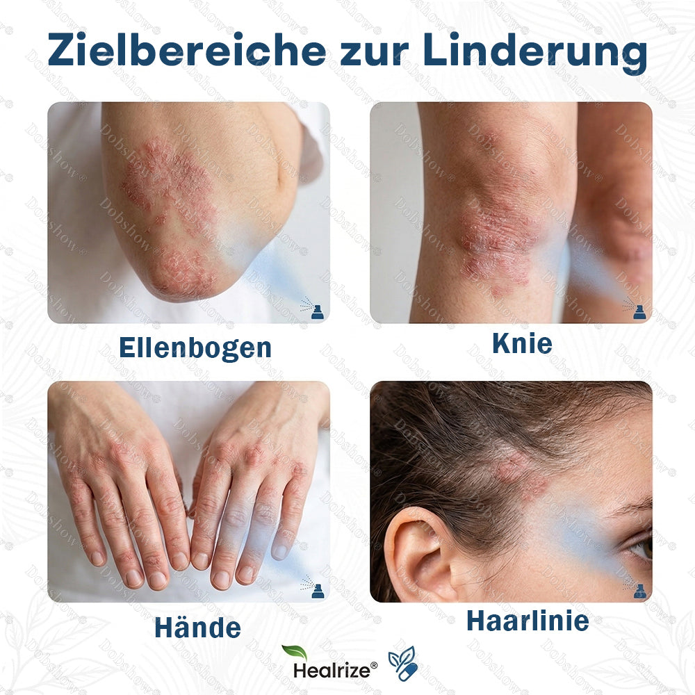 ✨DE 𝐎𝐟𝐟𝐢𝐜𝐢𝐚𝐥  𝐒𝐭𝐨𝐫𝐞 | Healrize® Magnesium-Pflanzenspray – Fortschrittliche Hautregeneration bei Schuppenflechte & Ekzemen | Schnelle Linderung, steroidfrei