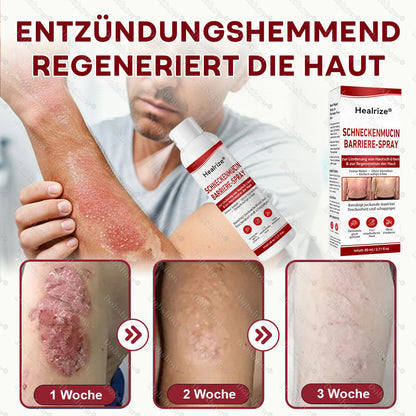 🎁DE 𝐎𝐟𝐟𝐢𝐜𝐢𝐚𝐥  𝐒𝐭𝐨𝐫𝐞 | Healrize® Schneckenmucin-Barriere-Spray zur Linderung von Hautschüben und zur Regeneration der Haut-𝘿𝙚𝙪𝙩𝙨𝙘𝙝𝙡𝙖𝙣𝙙𝙨 𝙉𝙧. 1 𝙨𝙥𝙧ü𝙝𝙗𝙖𝙧𝙚 𝘽𝙖𝙧𝙧𝙞𝙚𝙧𝙚-𝙋𝙛𝙡𝙚𝙜𝙚 𝙗𝙚𝙞 𝙋𝙨𝙤𝙧𝙞𝙖𝙨𝙞𝙨