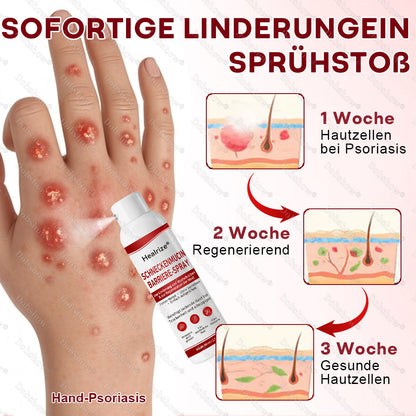 🎁DE 𝐎𝐟𝐟𝐢𝐜𝐢𝐚𝐥  𝐒𝐭𝐨𝐫𝐞 | Healrize® Schneckenmucin-Barriere-Spray zur Linderung von Hautschüben und zur Regeneration der Haut-𝘿𝙚𝙪𝙩𝙨𝙘𝙝𝙡𝙖𝙣𝙙𝙨 𝙉𝙧. 1 𝙨𝙥𝙧ü𝙝𝙗𝙖𝙧𝙚 𝘽𝙖𝙧𝙧𝙞𝙚𝙧𝙚-𝙋𝙛𝙡𝙚𝙜𝙚 𝙗𝙚𝙞 𝙋𝙨𝙤𝙧𝙞𝙖𝙨𝙞𝙨