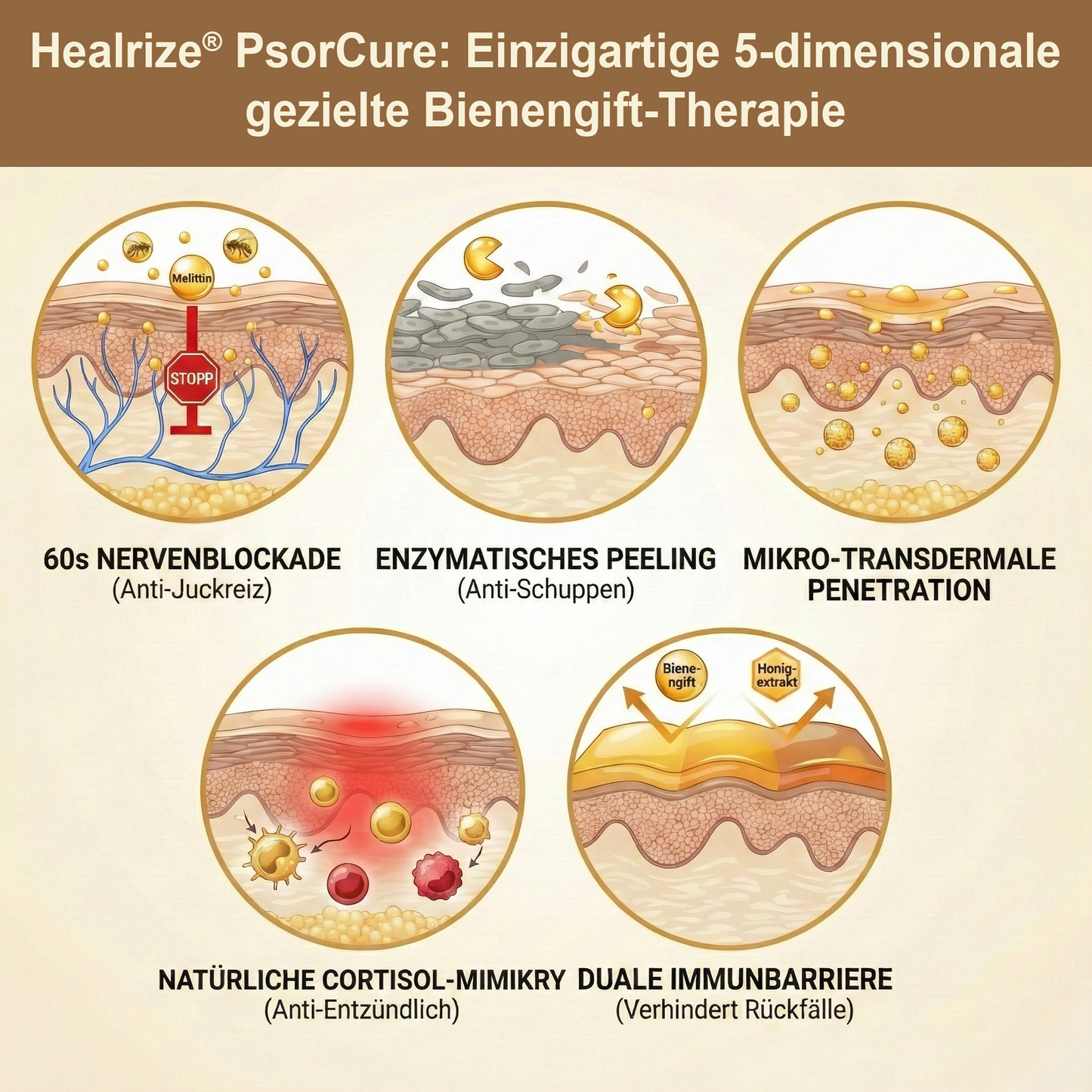 📅👨‍⚕️𝙈ä𝙧𝙯-𝘼𝙣𝙜𝙚𝙗𝙤𝙩 | Healrize® PsorCure Bienengift Zielgerichtete Linderungscreme