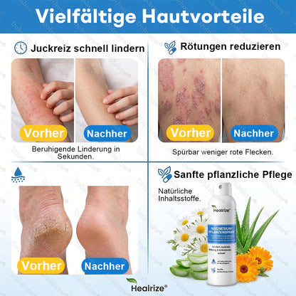 ✨DE 𝐎𝐟𝐟𝐢𝐜𝐢𝐚𝐥  𝐒𝐭𝐨𝐫𝐞 | Healrize® Magnesium-Pflanzenspray – Fortschrittliche Hautregeneration bei Schuppenflechte & Ekzemen | Schnelle Linderung, steroidfrei